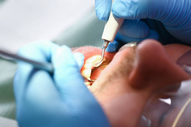 Best 24-Hour Emergency Dentist in Rden City, GA