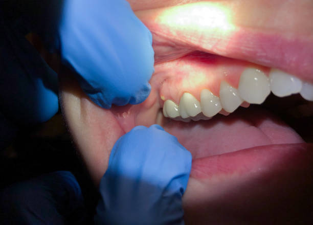 Best Walk-In Emergency Dentist in Rden City, GA