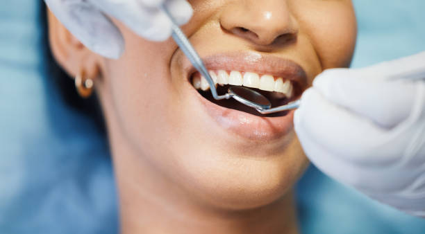 Best Weekend Emergency Dentist in Rden City, GA
